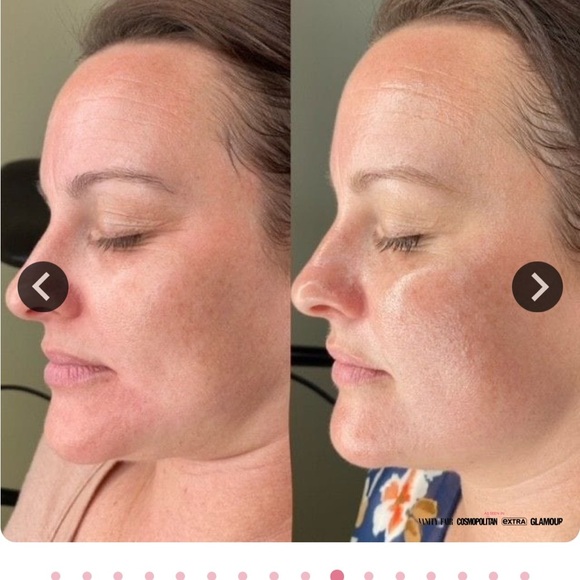 Wellnature Glass Skin Masks 4 masks per pack - Picture 8 of 9